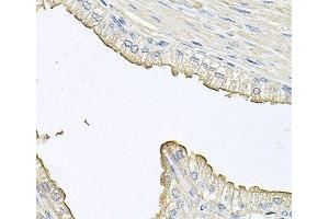 Immunohistochemistry of paraffin-embedded Human prostate using FABP12 Polyclonal Antibody at dilution of 1:100 (40x lens). (FABP12 anticorps)