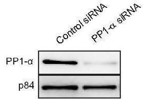 WB Image WB to detect PP1 alpha from U2OS cells treated with control siRNA or PP1 alpha siRNA, using  at 1:1000 dilution.