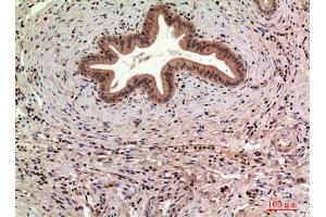 Immunohistochemistry (IHC) analysis of paraffin-embedded Human Liver, antibody was diluted at 1:100. (CD63 anticorps  (Internal Region))