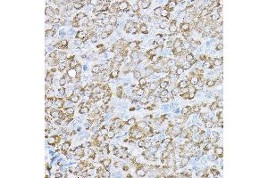 Immunohistochemistry of paraffin-embedded rat ovary using UBE2F Rabbit pAb  at dilution of 1:200 (40x lens).