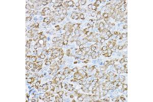 Immunohistochemistry of paraffin-embedded rat ovary using UBE2F Rabbit pAb  at dilution of 1:200 (40x lens). (UBE2F anticorps  (AA 1-185))
