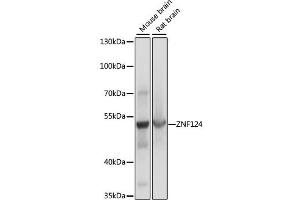 Western blot analysis of extracts of various cell lines, using ZNF124 antibody. (ZNF124 anticorps)