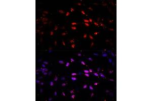 Immunofluorescence analysis of NIH/3T3 cells using KDM6B antibody (ABIN6131823, ABIN6142806, ABIN6142809 and ABIN6216507) at dilution of 1:100. (Kdm6b anticorps  (AA 265-450))