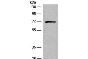 Western blot analysis of Jurkat cell lysate using ADGRE3 Polyclonal Antibody at dilution of 1:550 (EMR3 anticorps)