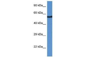 Western Blot showing CAMK2B antibody used at a concentration of 1 ug/ml against THP-1 Cell Lysate (CAMK2B anticorps  (Middle Region))