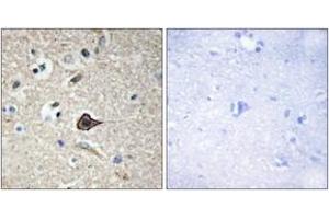 Immunohistochemistry analysis of paraffin-embedded human brain, using TNF12 Antibody. (TWEAK anticorps  (AA 41-90))