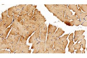 Detection of LIFR in Mouse Skeletal muscle Tissue using Polyclonal Antibody to Leukemia Inhibitory Factor Receptor (LIFR)