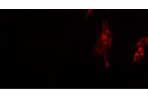 ABIN6272646 staining Hela by IF/ICC. (PODXL2 anticorps  (C-Term))