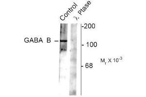 Image no. 1 for anti-gamma-aminobutyric Acid (GABA) B Receptor, 2 (GABBR2) (pSer783) antibody (ABIN372643) (GABBR2 anticorps  (pSer783))