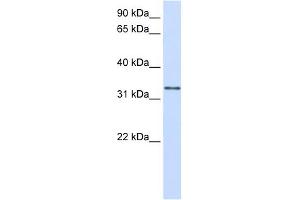 GPSN2 antibody used at 1 ug/ml to detect target protein. (TECR anticorps  (C-Term))