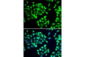 Immunofluorescence analysis of A-549 cells using SGTA antibody. (SGTA anticorps  (AA 1-120))