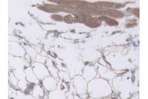 IHC-P analysis of Mouse Skin Tissue, with DAB staining. (Filaggrin anticorps  (AA 119-336))