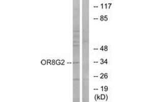 Western blot analysis of extracts from HT-29 cells, using OR8G2 Antibody. (OR8G2 anticorps  (AA 237-286))