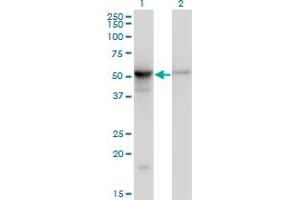 Western Blot analysis of TUBB2A expression in transfected 293T cell line by TUBB2A monoclonal antibody (M03), clone 2B2.