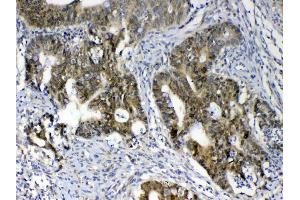 IHC analysis of GALE using anti-GALE antibody . (GALE anticorps  (AA 1-340))