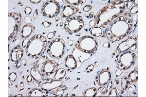 Immunohistochemical staining of paraffin-embedded Human Kidney tissue using anti-TBXAS1 mouse monoclonal antibody. (TBXAS1 anticorps)