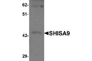 Western Blotting (WB) image for anti-Shisa Homolog 9 (Shisa9) (Middle Region) antibody (ABIN1031091) (Shisa9 anticorps  (Middle Region))
