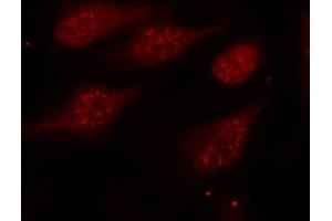 Immunofluorescence staining of methanol-fixed Hela cells, using Phospho-TP53-S315 antibody. (p53 anticorps  (pSer315))