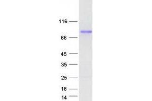 Validation with Western Blot