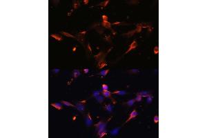 Immunofluorescence analysis of NIH/3T3 cells using CLDN5 antibody (ABIN6127705, ABIN6138692, ABIN6138693 and ABIN6214365) at dilution of 1:100.