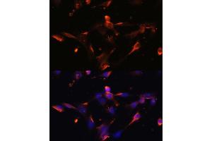 Immunofluorescence analysis of NIH/3T3 cells using CLDN5 antibody (ABIN6127705, ABIN6138692, ABIN6138693 and ABIN6214365) at dilution of 1:100. (Claudin 5 anticorps  (AA 230-303))
