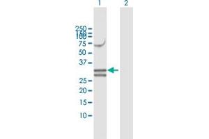 Western Blot analysis of NUDT6 expression in transfected 293T cell line by NUDT6 MaxPab polyclonal antibody. (NUDT6 anticorps  (AA 1-316))