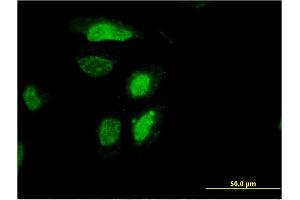 Immunofluorescence of monoclonal antibody to RDH12 on HeLa cell. (RDH12 anticorps  (AA 217-316))
