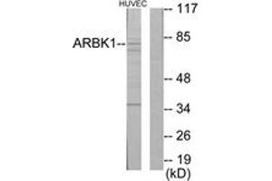 Western Blotting (WB) image for anti-Adrenergic, Beta, Receptor Kinase 1 (ADRBK1) (AA 601-650) antibody (ABIN2889434) (GRK2 anticorps  (AA 601-650))