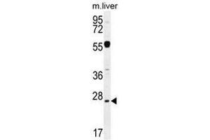 NPS3A Antibody (Center) western blot analysis in mouse liver tissue lysates (35µg/lane). (NIPSNAP3A anticorps  (Middle Region))