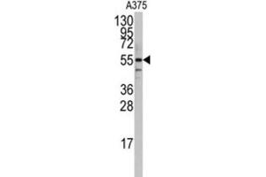 Western Blotting (WB) image for anti-Polymerase I and Transcript Release Factor (PTRF) antibody (ABIN3003202) (PTRF anticorps)