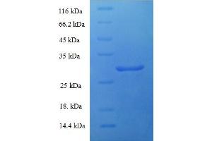 SDS-PAGE (SDS) image for Parathyroid Hormone 2 Receptor (PTH2R) (AA 27-145), (Extracellular) protein (His-SUMO Tag) (ABIN5710179)