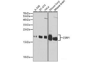 Western blot analysis of extracts of various cell lines using CSRP1 Polyclonal Antibody at dilution of 1:1000. (CSRP1 anticorps)