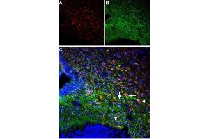 Multiplex staining of Parathyroid hormone receptor 1 and Orexin receptor 1 in rat ventromedial hypothalamus - Immunohistochemical staining of perfusion-fixed frozen rat brain sections using Anti-Orexin Receptor 1-ATTO Fluor-488 Antibody (ABIN7043286), (1:60) and Anti-PTH1R (extracellular) Antibody (ABIN7043429, ABIN7045112 and ABIN7045113), (1:60). (PTH1R anticorps  (1st Extracellular Loop))