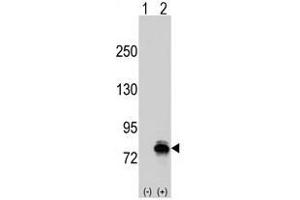 Image no. 1 for anti-K-Cadherin (CDH6) (N-Term) antibody (ABIN356889)