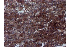 Image no. 5 for anti-Complement Component 1, S Subcomponent (C1S) antibody (ABIN1497565) (C1S anticorps)