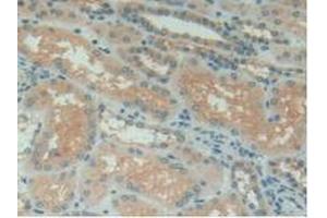Detection of C1INH in Human Kidney Tissue using Polyclonal Antibody to Complement 1 Inhibitor (C1INH)