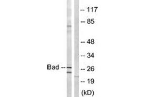 Western blot analysis of extracts from mouse liver cells, using BAD (Ab-134) Antibody. (BAD anticorps  (AA 100-149))