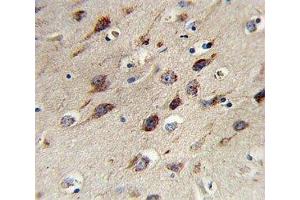 IHC analysis of FFPE human brain stained with BDNF antibody