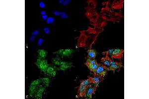 Immunocytochemistry/Immunofluorescence analysis using Rabbit Anti-Calcium Sensing Receptor Polyclonal Antibody . (CASR anticorps  (AA 1-100) (HRP))