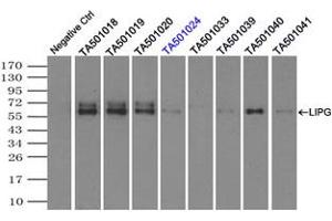 Image no. 1 for anti-Lipase, Endothelial (LIPG) antibody (ABIN1499166) (LIPG anticorps)