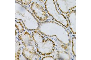 Immunohistochemistry of paraffin-embedded human kidney using PTPRA Antibody (ABIN3015783, ABIN3015784, ABIN1682399 and ABIN6219134) at dilution of 1:100 (40x lens).