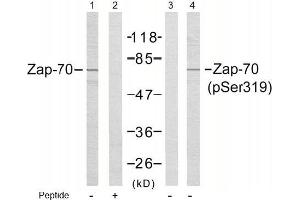 Image no. 1 for anti-zeta-Chain (TCR) Associated Protein Kinase 70kDa (ZAP70) (pTyr319) antibody (ABIN196884) (ZAP70 anticorps  (pTyr319))