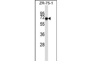 CD5 Antibody (Center) (ABIN657456 and ABIN2846483) western blot analysis in ZR-75-1 cell line lysates (35 μg/lane). (CD5 anticorps  (AA 203-232))