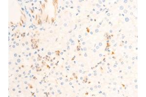ABIN6267302 at 1/100 staining human liver tissue sections by IHC-P.