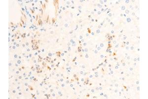 ABIN6267302 at 1/100 staining human liver tissue sections by IHC-P. (ICAM1 anticorps  (pTyr512))