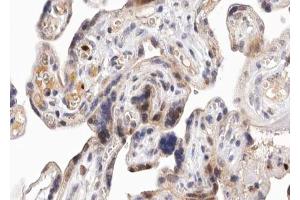 ABIN6267653 at 1/100 staining human Placenta tissue sections by IHC-P. (PKD1/2/3/PKC mu (pSer738), (pSer742) anticorps)
