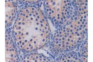DAB staining on IHC-P; Samples: Mouse Testis Tissue (Fatty Acid Synthase anticorps  (AA 2257-2504))