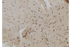 ABIN6279296 at 1/100 staining Mouse liver tissue by IHC-P. (CHD8 anticorps  (C-Term))