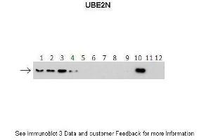 Lanes:   1: 40ng HIS-UBE2D1 protein 2: 40ng HIS-UBE2D2 protein 3: 40ng HIS-UBE2D3 protein 4: 40ng HIS-UBE2D4 protein 5: 40ng HIS-UBE2E1 protein 6: 40ng HIS-UBE2E2 protein 7: 40ng HIS-UBE2E3 protein 8: 40ng HIS-UBE2K protein 9: 40ng HIS-UBE2L3 protein 10: 40ng HIS-UBE2N protein 11: 40ng HIS-UBE2V1 protein 12: 40ng HIS-UBE2V2 protein. (UBE2N anticorps  (Middle Region))
