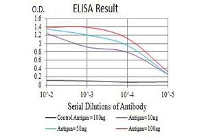 Black line: Control Antigen (100 ng),Purple line: Antigen (10 ng), Blue line: Antigen (50 ng), Red line:Antigen (100 ng)